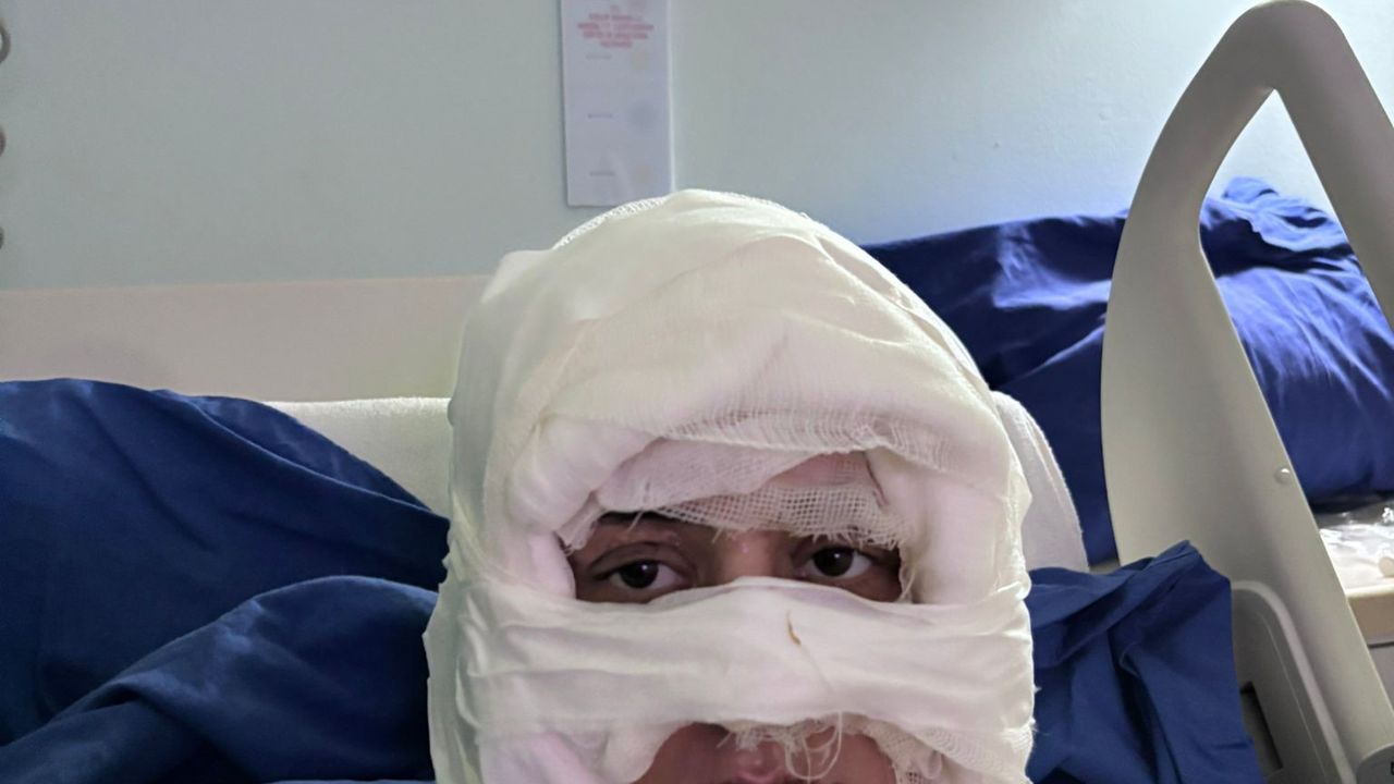 Genç kadın üzerine benzin dökülerek yakıldı