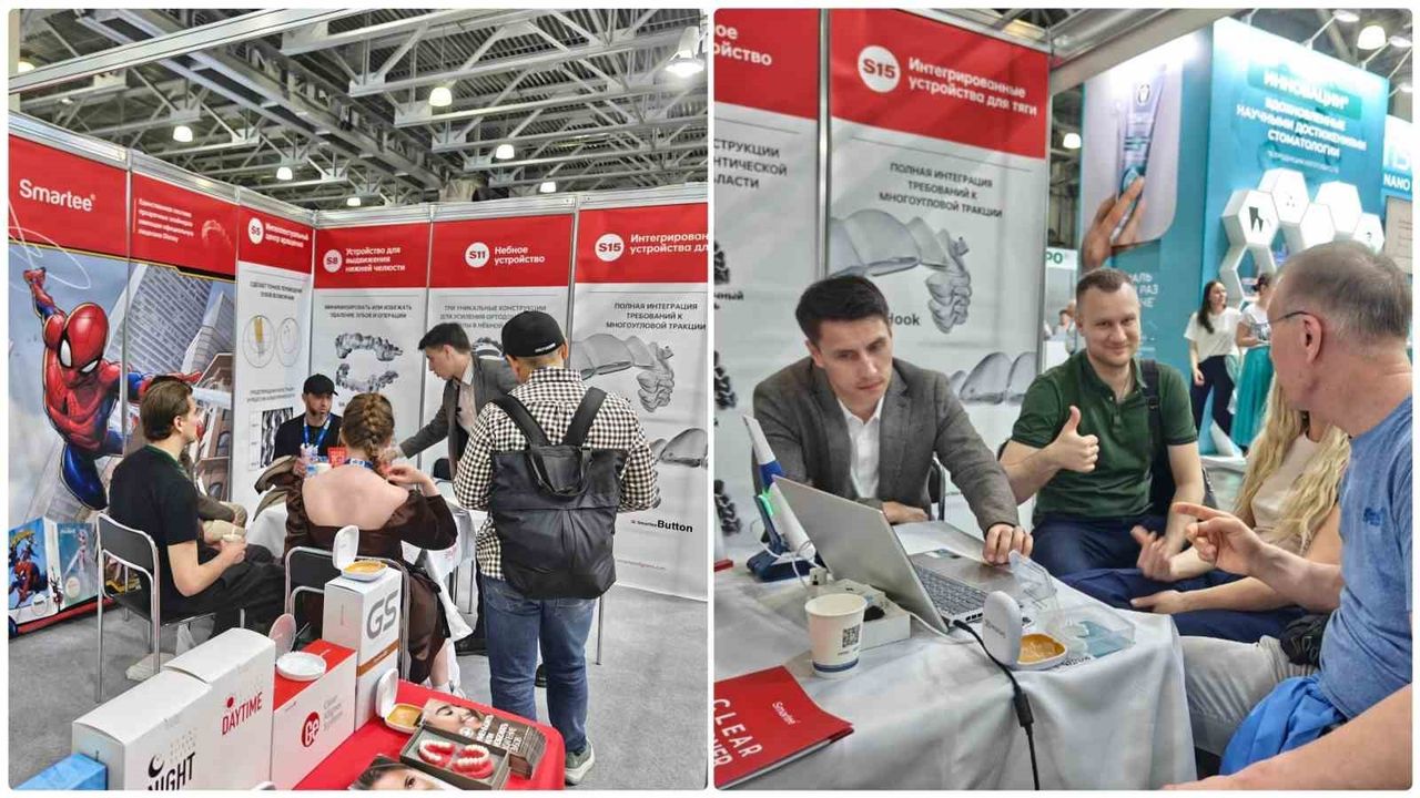 Ortodontide yeni dönem: Smartee, Rusya ve Orta Asya'da dikkatleri üzerine çekti