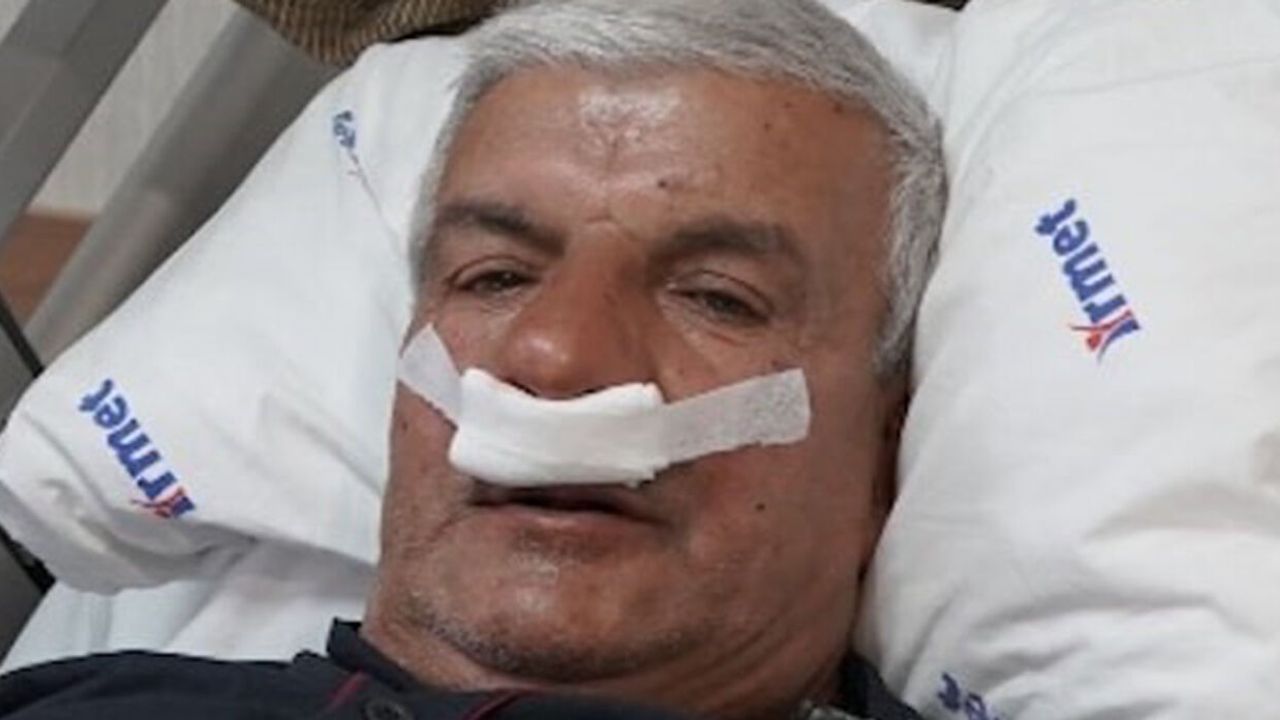 65 yaşındaki adamın burnundan 100 gramlık taş çıkarıldı