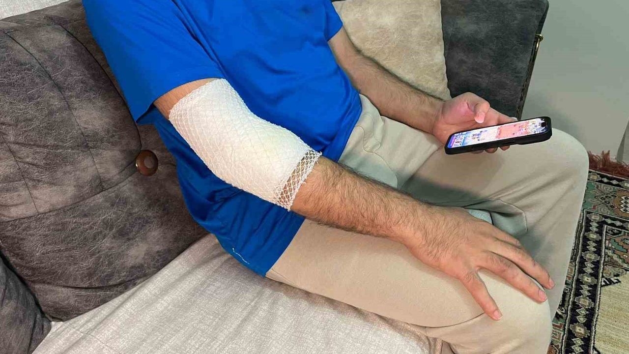 Başakşehir'de sitenin güvenlik görevlisine sahipli köpek saldırdı