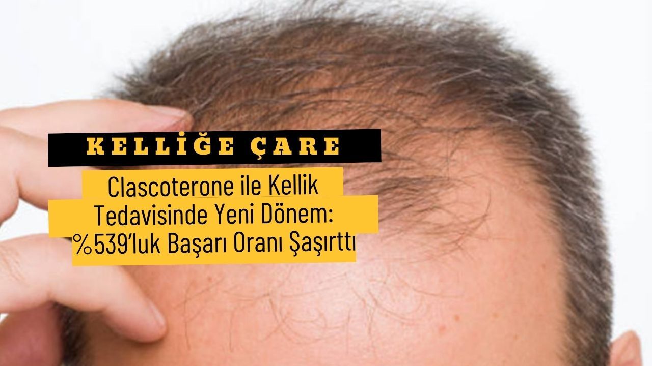 Kelliğe Çare Bulundu : İşte Detaylar