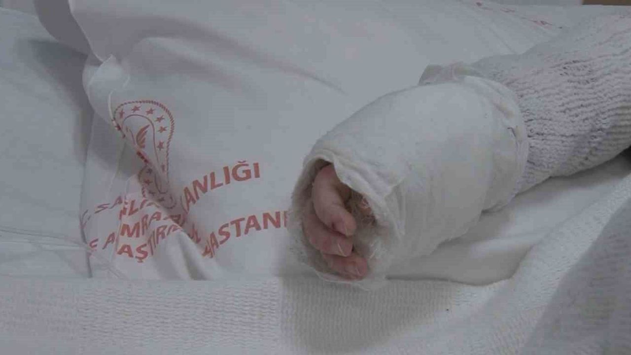 Üzerine kaynar su dökülen bebeğin vücudunun yüzde 27'si yandı