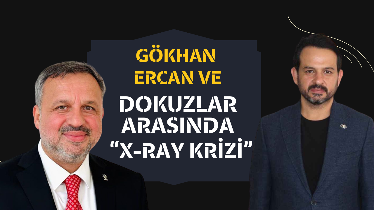 Gökhan Ercan ve Dokuzlar Arasında X-Ray Krizi