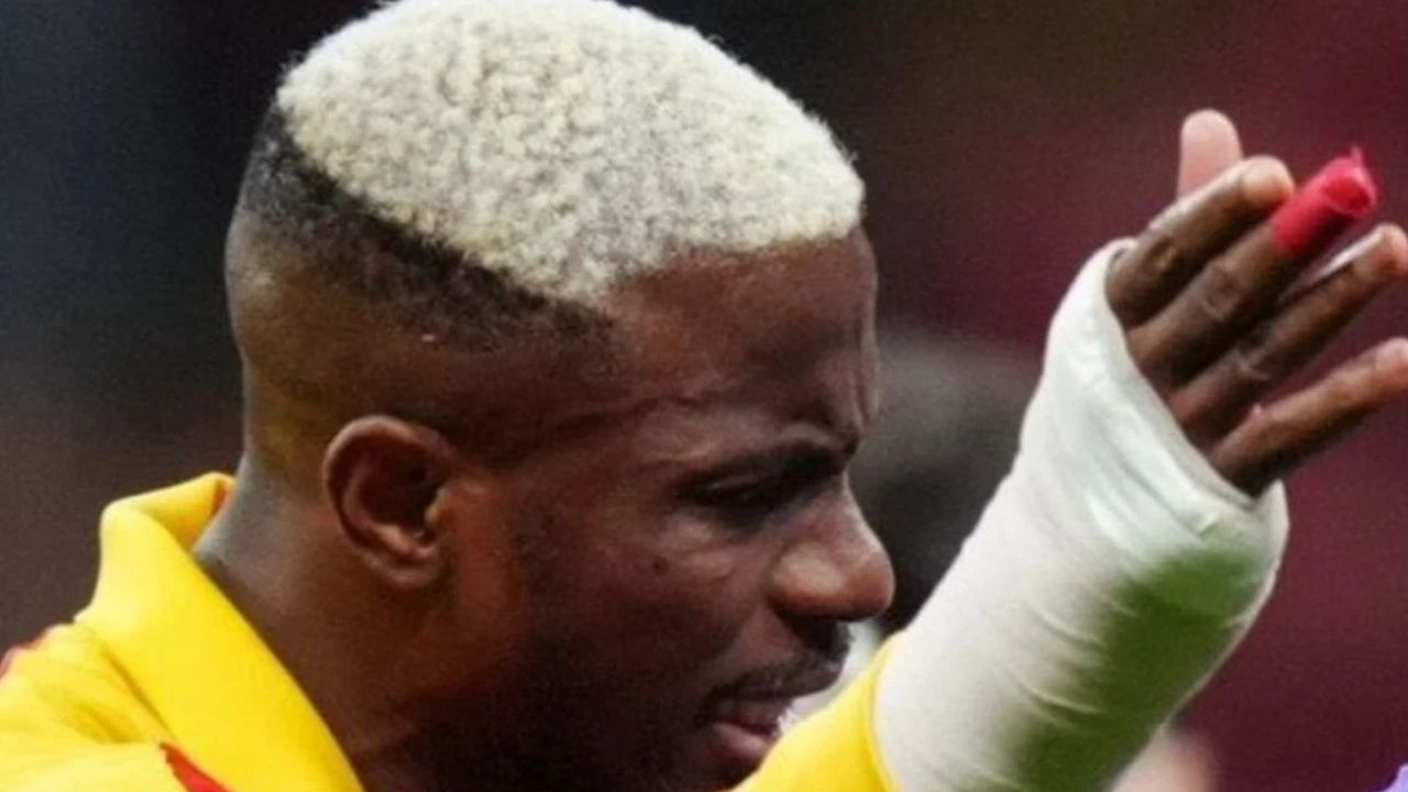 Maçlarda alçılı kolla oynamak yasak mı? TFF ve IFAB'ın koruma kuralları neler?