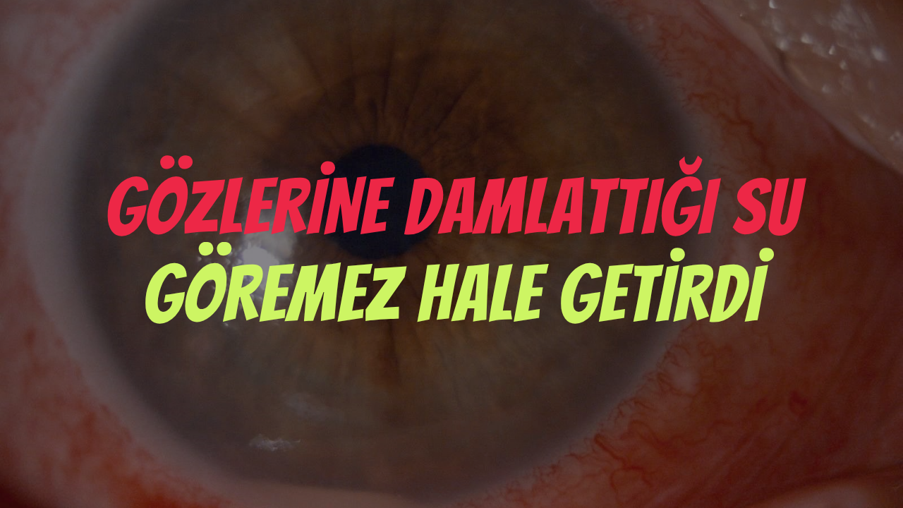 Kocaeli'de Gözlerine Damlattığı Su Göremez Hale Getirdi