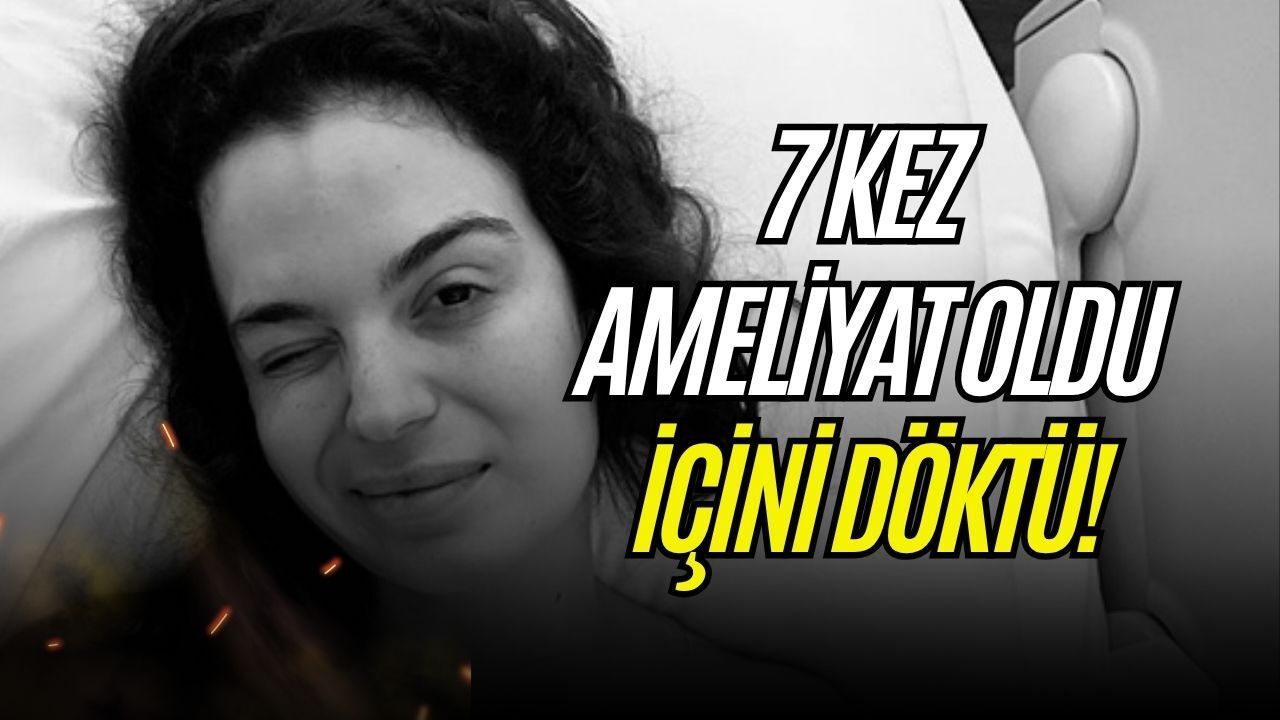 7 Kez Ameliyat Olan Aslı Bekiroğlu İçini Döktü: Bedenim Deforme Olduğu İçin Mutsuzum