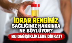 İdrar renginiz sağlığınız hakkında ne söylüyor? Bu değişikliklere dikkat!