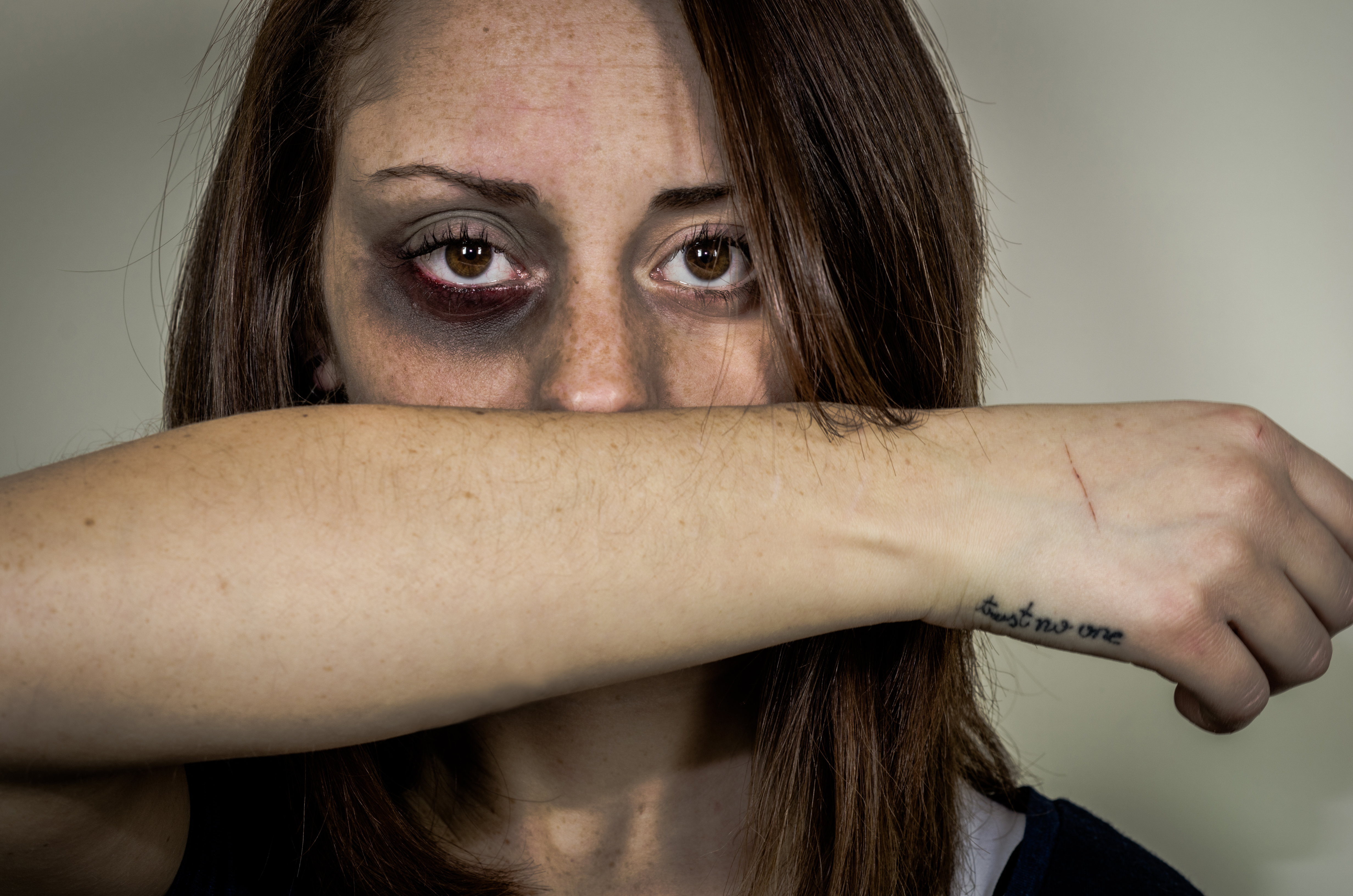 Beaten Woman Standing In Front Of A Dark Wall Demo 2025 02 10 11 18 20 Utc