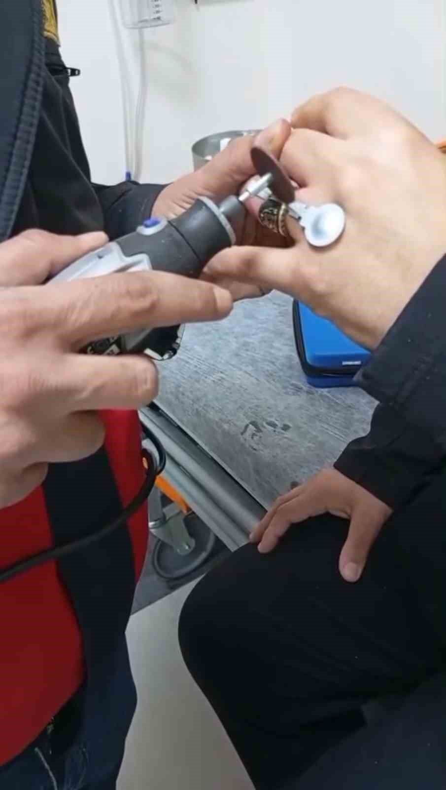 Sıkışan Yüzük Itfaiye Ekiplerince Çıkarıldı 2