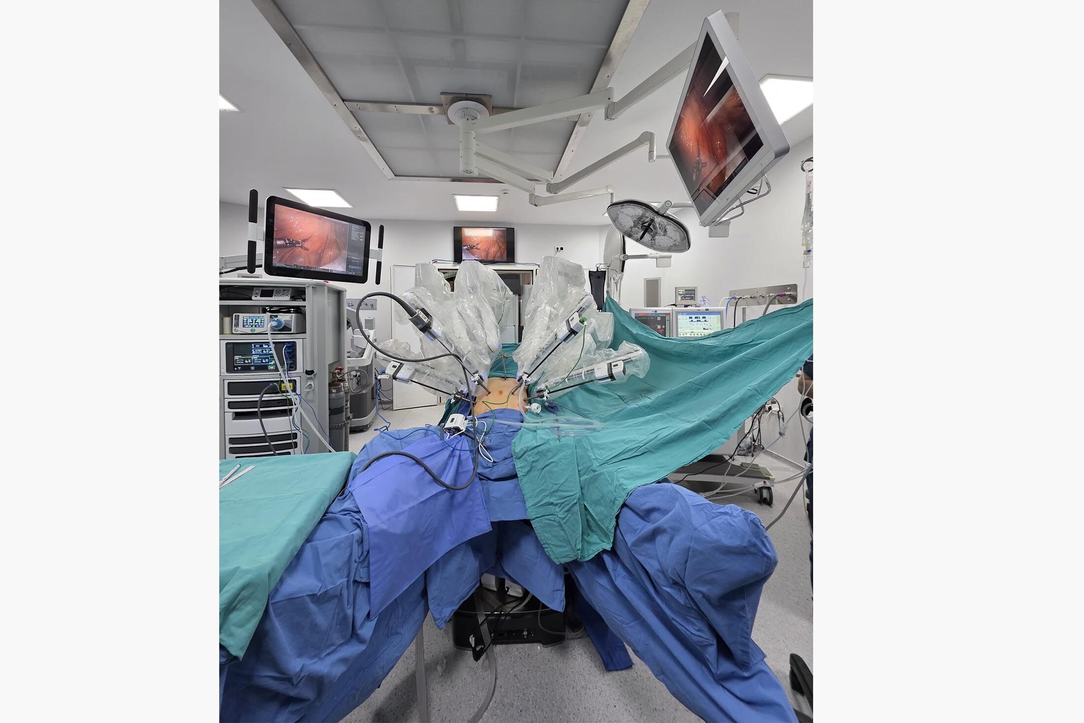 20260121 1E023 2026011395Ba9Robotikcerrahi 1 E66 831