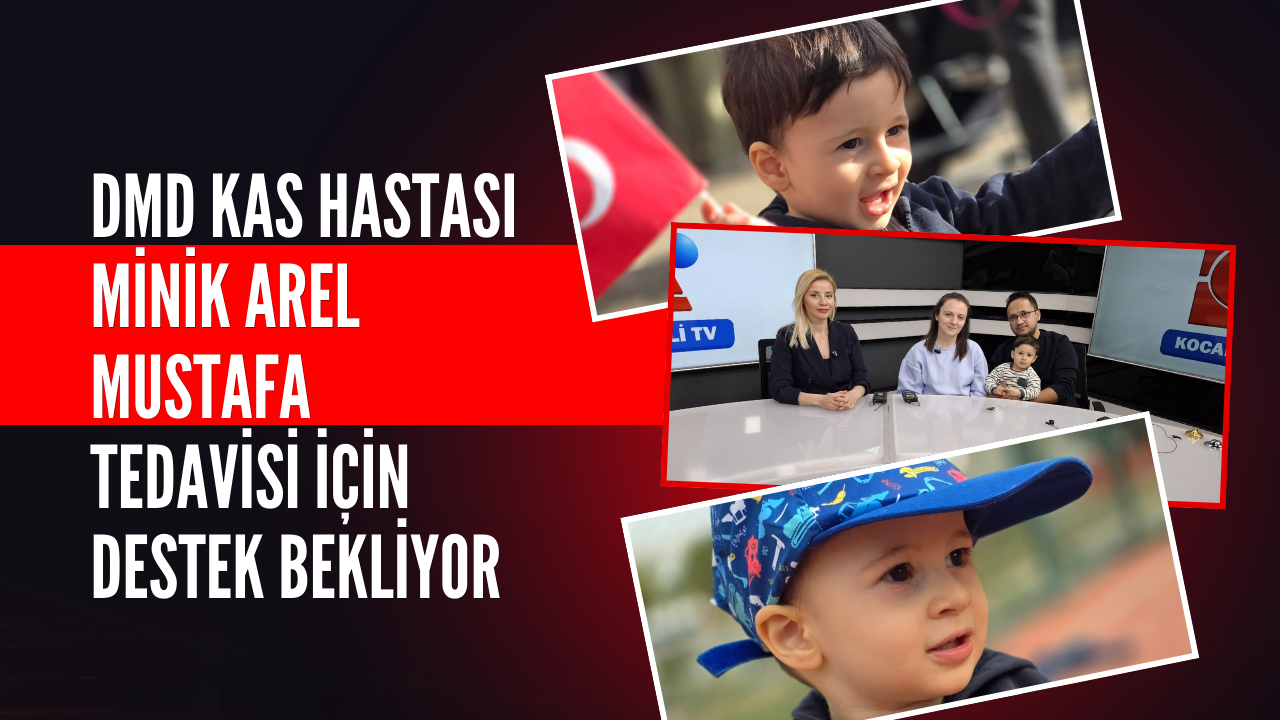 Dmd Kas Hastasi Arel Mjustafa Tedavi̇si̇ İçi̇n Destek Bekli̇yor