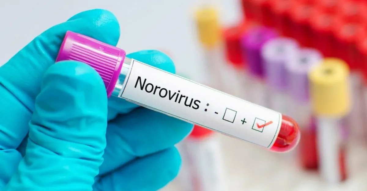 1200X627 Norovirus Nedir Norovirus Belirtileri Nelerdir Tedavisi Nasil Bulasici Mi 1631635944159